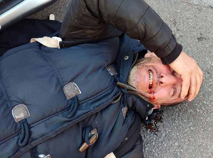 شخص عايش في فرنسا ضرب خوه بطوموبيل كان غادي يصفيها ليه قبل الفطور باش يخرجو من الدار اللي عايش فيها كثر من عشرين عام