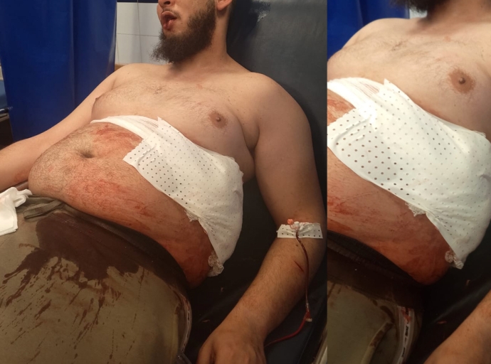 محاولة قتل في حي المدرسة تنتهي بإلقاء القبض على الجاني في وقت قياسي